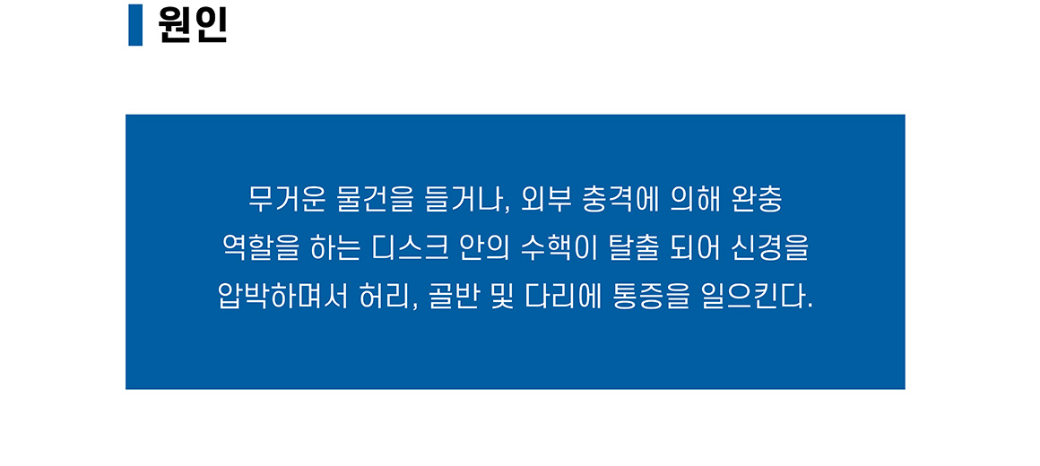 허리디스크 원인