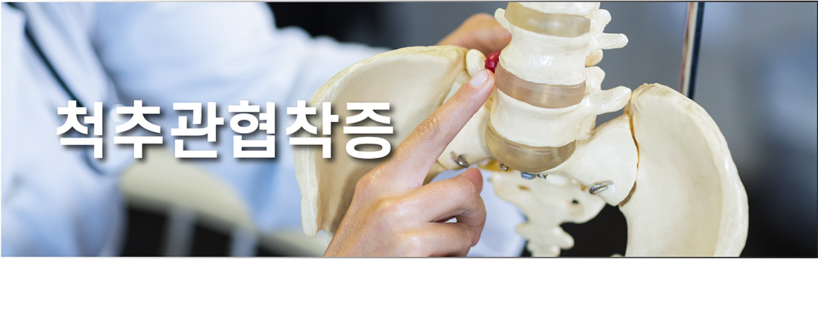 척추관협착증